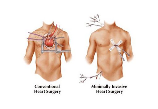 Cutting Edge Facility
